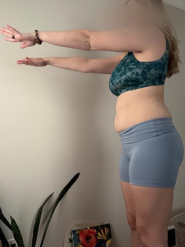 Client N before coaching, side profile (face hidden for privacy)